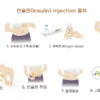 간호사 임상용어 인슐린주사절차