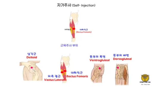 이미지로 쉽게 설명하는 의학용어