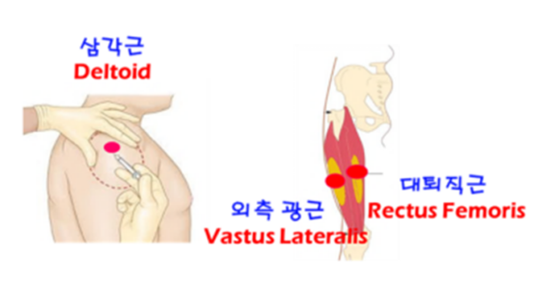 IM 신경손상예방법: 그림으로 배우는 의학용어